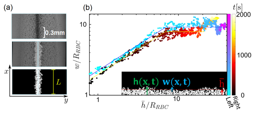 Micrographs and data collapse of a drying red-cell droplet