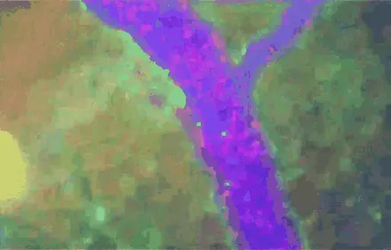 Merged fluorescence channels of the microvessel