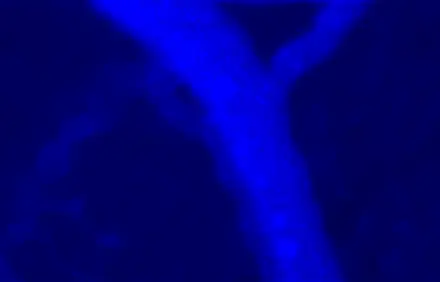 Plasma channel (FITC-dextran) of an intravital recording