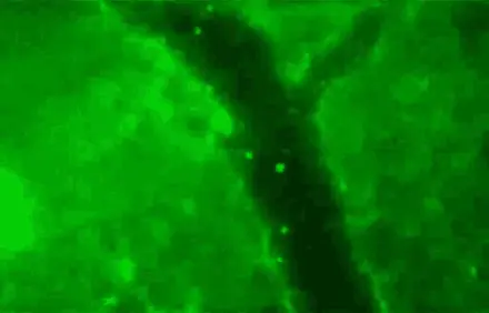 Labelled rigidified red blood cells (PKH26) flowing through a microvessel